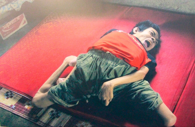 Hue exhibition shows USs deadly Agent Orange legacy