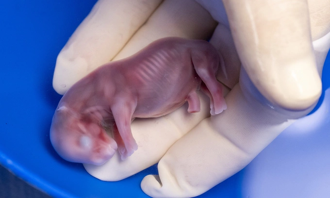 In this photograph released by the Leibniz Institute for Zoo and Wildlife Research, Dr. Thomas Hildbrandt, head of projects, holds a white rhinoceros embryo that was created in a lab from an egg and sperm that had been previously collected from other rhinos and later transferred into a southern white rhino surrogate mother, in Kenya, Nov. 29, 2023. Photo handed out via AP